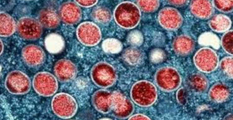 An image showing the mpox virus under the microscope.