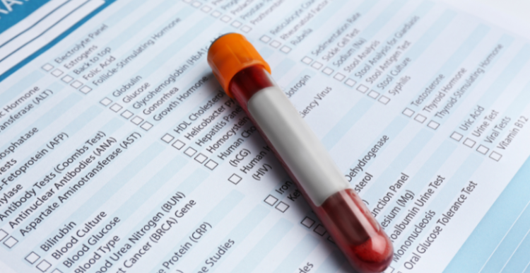A test tube containing blood placed over a blood test sheet of paper.