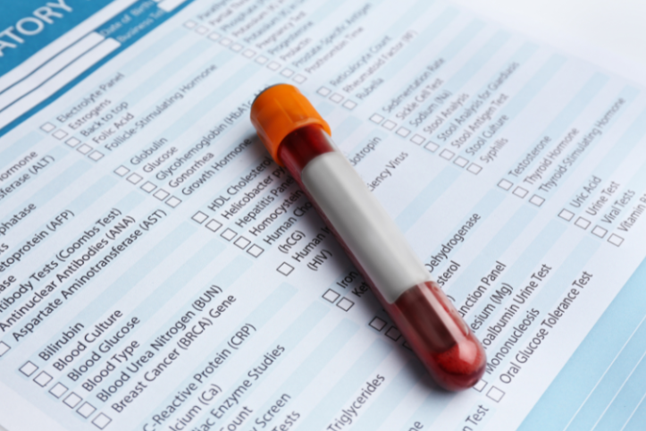 A test tube containing blood placed over a blood test sheet of paper.