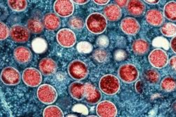 An image showing the mpox virus under the microscope.